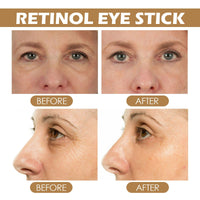 Turmeric Retinol Eye Cream Stick,Eye Cream Stick for Dark Circles and Puffy Eyes,Dark Circle Eye Cream Stick,Anti Wrinkle Eye Cream,Firming Eye Cream Stick,Retinol Eye Cream Stick to Reduce Fine Lines
