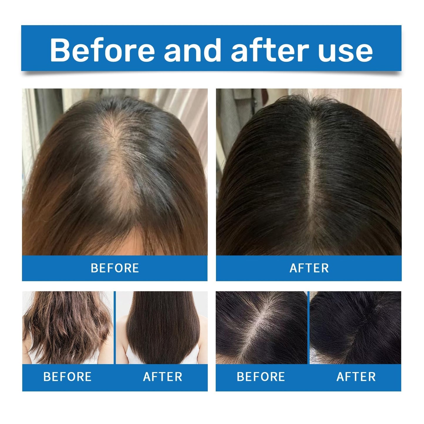 Sca-lp Hair Ampoule,Hair Growth Serum,Cooling Hair Ampoule,Anti Hair Loss Essence,Hair Serum for Hair Loss,Ha-ir Regr-owth Se-rum,Hair Gro-wth Ser-um for Women,Hai-r Grow-th Oil for Men