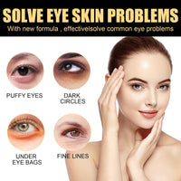 Retinol Intense Reactivating Eye Cream,Retinol Eye Cream,Anti Aging Eye Cream,Under Eye Cream,Eye Cream for Dark Circles and Puffy Eyes,Eye Bags Remover,Eye Cream Anti Aging,Anti Wrinkle Eye Cream