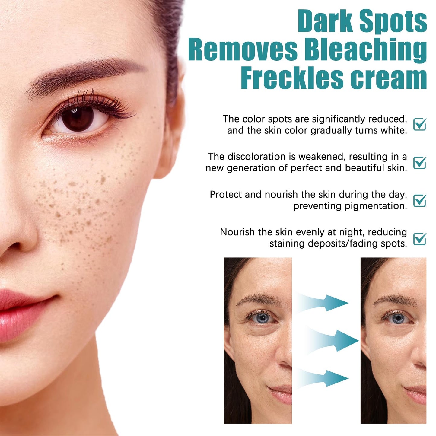 Nadiaen 2 Pcs Dark Spot Remover for Face,Age Spot Remover Hyperpigmentation Treatment-Sun Spots and Melasma Treatment Cream for Face, Pigmentation Freckle Removal Cream