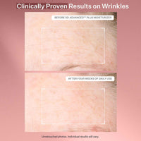 StriVectin SD Advanced™ Plus Intensive Moisturizer for Wrinkles & Stretchmarks, For Face & Body, Collagen Boosting with Peptides & Hyaluronic Acid