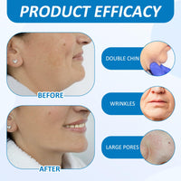 ExcellaElite 3 Pcs of V Line Face Lifting Chin Mask Strap for Double Chin Lifting Mask Multiple Active Ingredients Firming Skin Lifting Facial Skin
