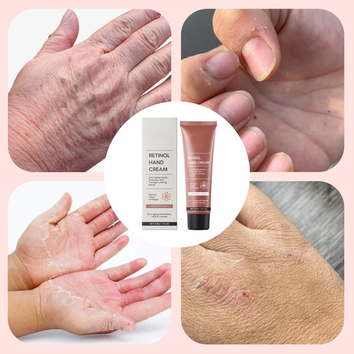 Anti-Aging Retinol Hand Cream,Firming Hand Lotion,Anti Wrinkle Cream for Hand,Retinol Moisture Hand Cream,Refreshing Texture & Easily Absorbed,Mild and Non-Irritating,for Aging & Dry Cracked Hands