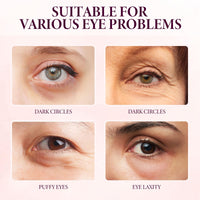 Siyinzu Eyelift Serum Mango Revitalize Eye Cream,Mango Activating and Firming Eye Cream,Hyaluronic Acid Repair Cream,E/ye Cre/am for Dark Circles and Puffy Eyes,Under Ey/e Cre/am,Anti Aging Ey/e Crea/m