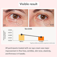Ginseng & Retinol Eye Cream, Revive Under Eye Serum, Korean Eye Cream, Eye Cream For Dark Circles And Puffy Eyes, Anti-Aging & Wrinkle, Vegan Korean Skincare, 50ml Visible Results In 4 Weeks
