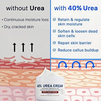 40% Urea Cream - Hand & Foot Creams, Urea Foot Cream Fast-Acting Cracked Heel Repair, Hydrating Lotion for Cracked Heels and Dry Skin Deep Moisturizing, Softens Calluses, Nourishes Rough Skin