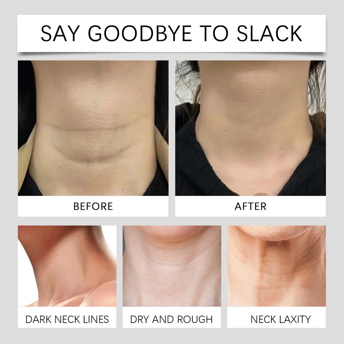 AurolaGlow Instant Neck Lift Tape – Invisible Face & Neck Lifting Patch for Women. Effortlessly Smooth Wrinkles, Double Chin & Saggy Skin Perfect for Women & Girls(4 Elastic Bands and 20 Replacement Patch)
