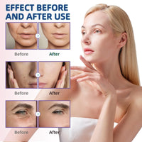 2PCS Liquid Solution Serum&Intense Eye Cream,Ola/vita Serum & Intense Eye Revive Cream,Liquid Wrinkle Remove Serum & Eye Cream,Ola/vitas Solution