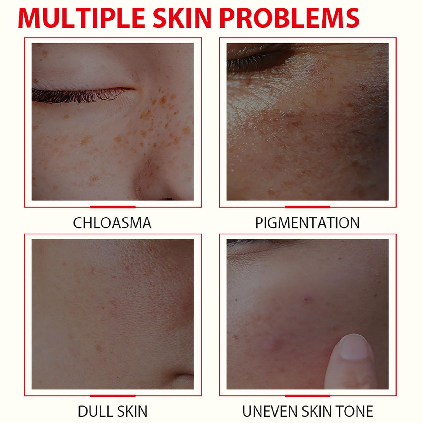 ISBEAUSOLS Glutathione Serum - Kojic Acid Serum for Skin Lig_htening - Dark Spot Correcting Glow Serum - Vitamin C Serum for Face - Hydrating Serum - Facial Serum for Even Skin Tone, Moisturising (30ml)