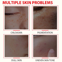 ISBEAUSOLS Glutathione Serum - Kojic Acid Serum for Skin Lig_htening - Dark Spot Correcting Glow Serum - Vitamin C Serum for Face - Hydrating Serum - Facial Serum for Even Skin Tone, Moisturising (30ml)