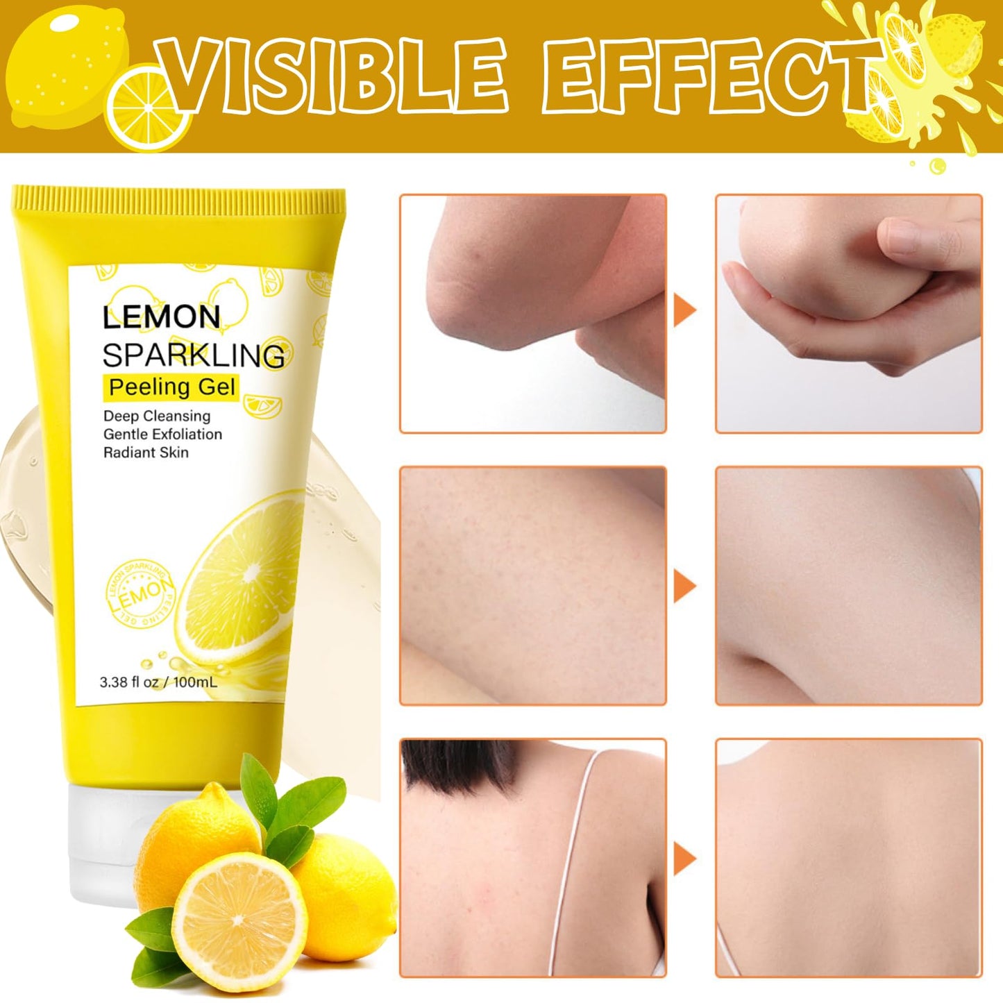 Trendyfave Lemon Peeling Gel, Vita Lemon Face Scrub Exfoliator with Purifying Exfoliating Gel – Vitamin C & Niacinamide for Glowing Skin, Face Exfoliator Scrub for Radiant Skin, Face & Body &Knee (100ml)