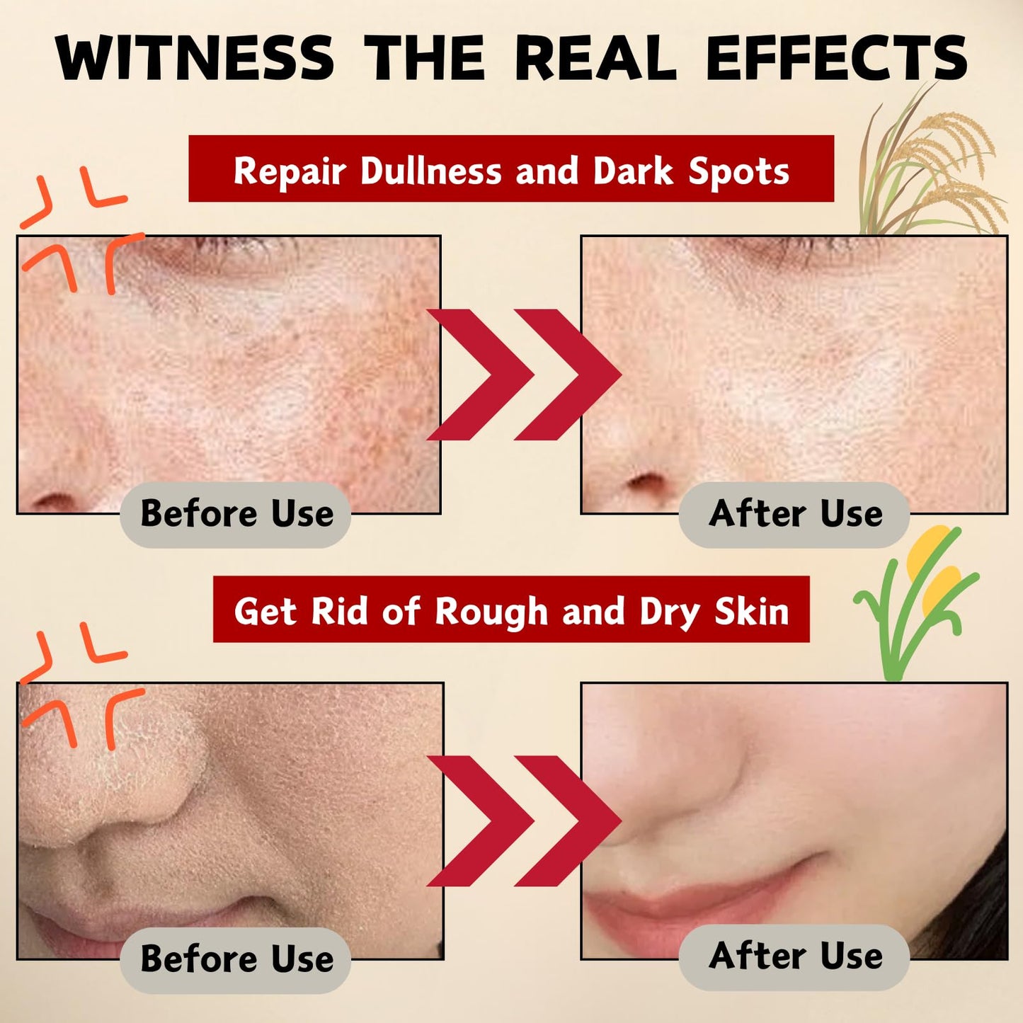 ISBEAUSOLS Glow Deep Serum Rice + Arbutin, Face Serum for Hyperpigmentation, Hydrating & Nourishing Rice Serum, Dark Spot Correcting Glow Serum, Anti Aging Serum, Even Skin Tone, Korean Skincare, 30ml