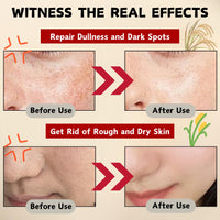ISBEAUSOLS Glow Deep Serum Rice + Arbutin, Face Serum for Hyperpigmentation, Hydrating & Nourishing Rice Serum, Dark Spot Correcting Glow Serum, Anti Aging Serum, Even Skin Tone, Korean Skincare, 30ml