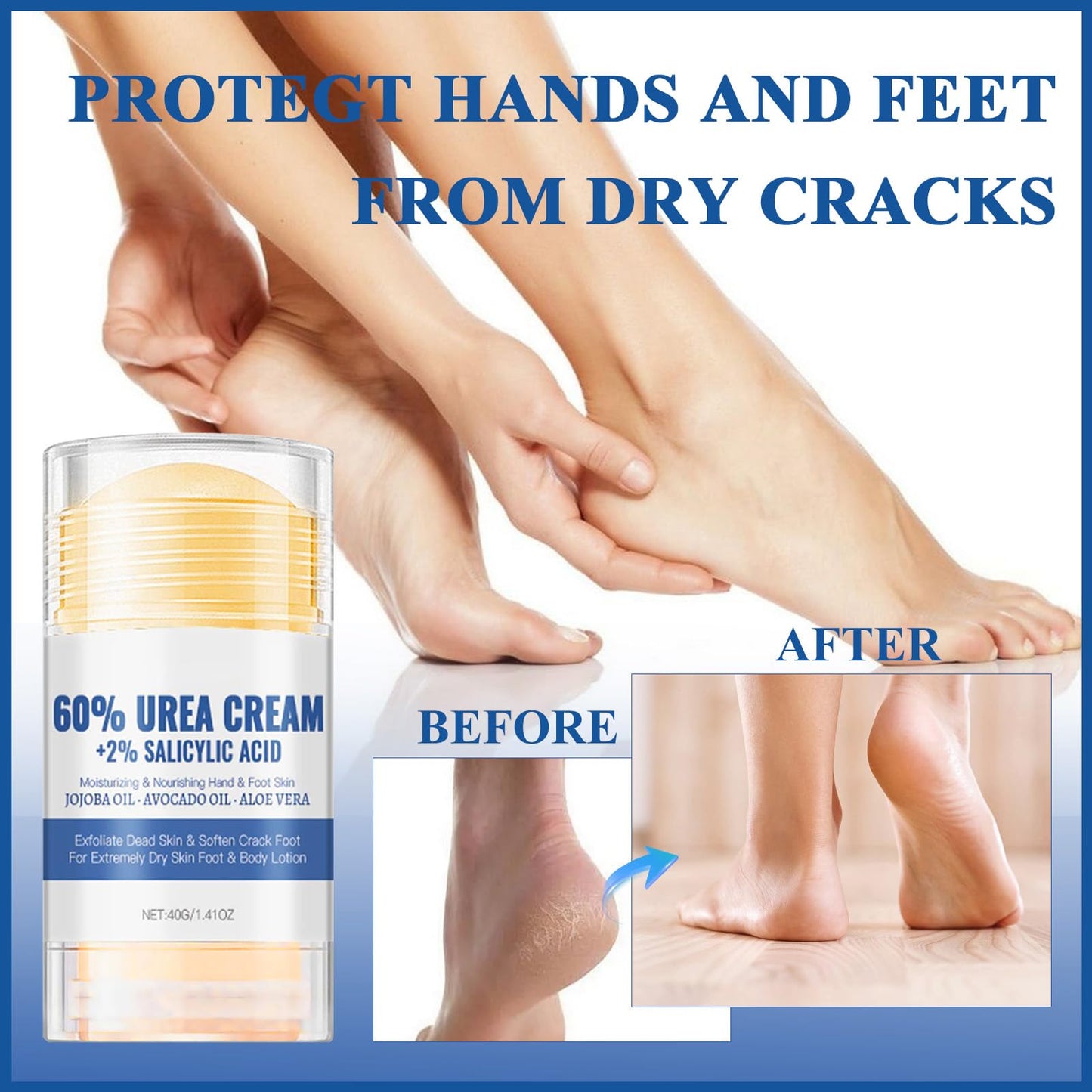 LUXRYNTH 2PCS Urea Cream 60% for Feet & Hands - Maximum Strength Foot Cream for Cracked Heels, Dry Skin Repair and Hard Skin Care - Moisturising Balm for Callus Treatment, Healthy Moisturiser
