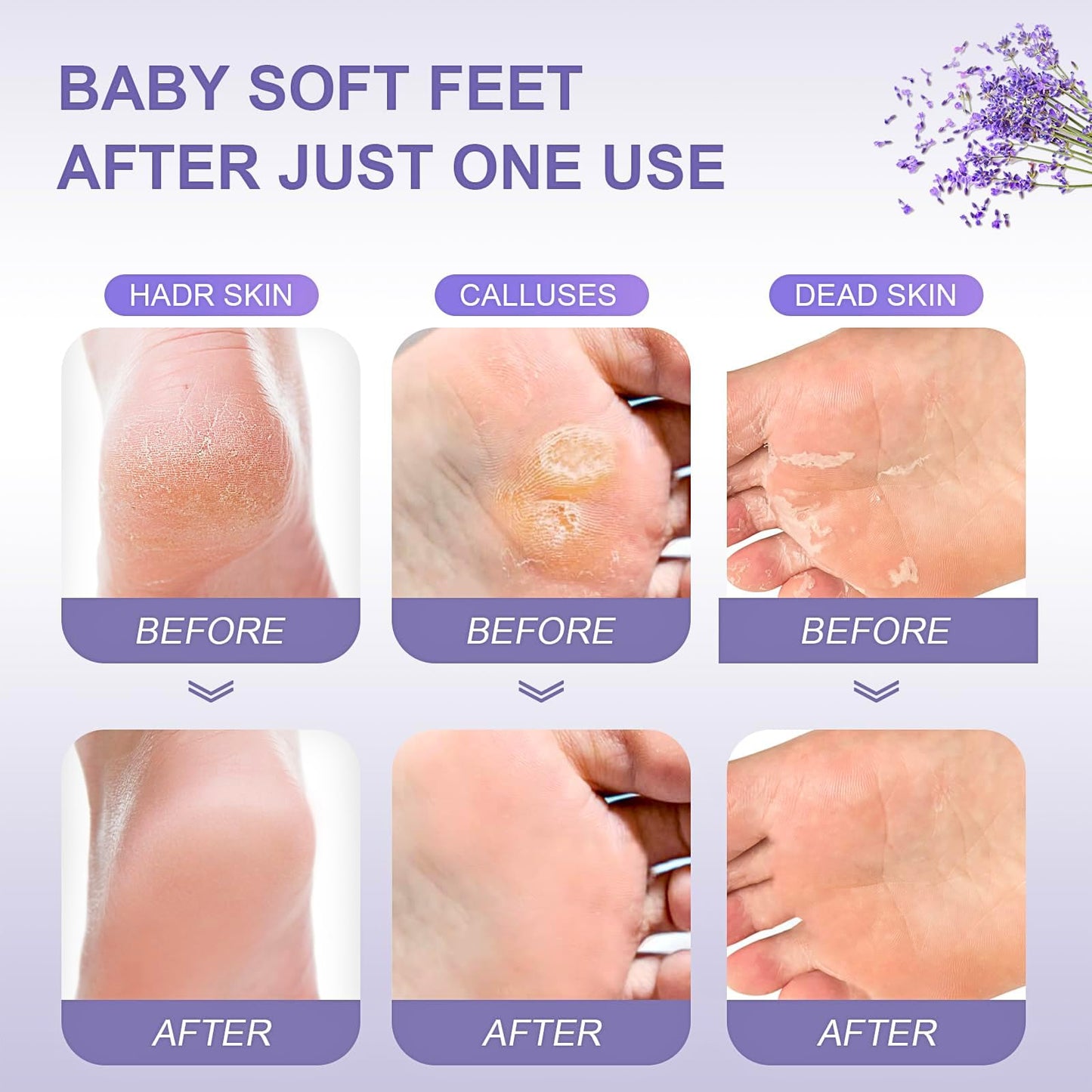 7PCS Foot Peel Mask for Hard Skin & Feet Scrubber & Socks, Exfoliating Foot Peel Mask, Callus Remover for Feet, Foot Moisturiser Socks for Foot Care