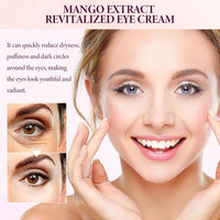 Siyinzu Eyelift Serum Mango Revitalize Eye Cream,Mango Activating and Firming Eye Cream,Hyaluronic Acid Repair Cream,E/ye Cre/am for Dark Circles and Puffy Eyes,Under Ey/e Cre/am,Anti Aging Ey/e Crea/m