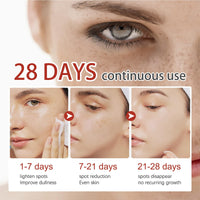 Kojic Acid Cream,Dark Spot Remover for Face,Skin Lightening Cream for Anti Aging,Dark Spot Correcting Glow Serum,Face Moisturizer for Women,Pigmentation Removal Cream,Freckle Removal Cream,Dark Spots