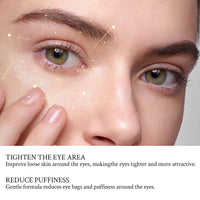 Belligern 2 Pcs Lumibalm for Under Eye Bags Lumibalm Eye Serum Lumibalm Eye Bags Lumi Balm Lumi Radiance Eye Balm Retinol Eye Cream Dark Circle Eye Cream Gentle Care, Lifting and Moisturizing Around the Eyes