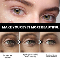 Fankayi Caffeine Eye Cream for Dark Circles and Puffy Eyes,Hyaluronic Acid Under Eye Cream for Dark Circles and Puffiness Anti Aging,E-ye Cr-eam for Lines and Wrinkles and Da-rk Cir-cles