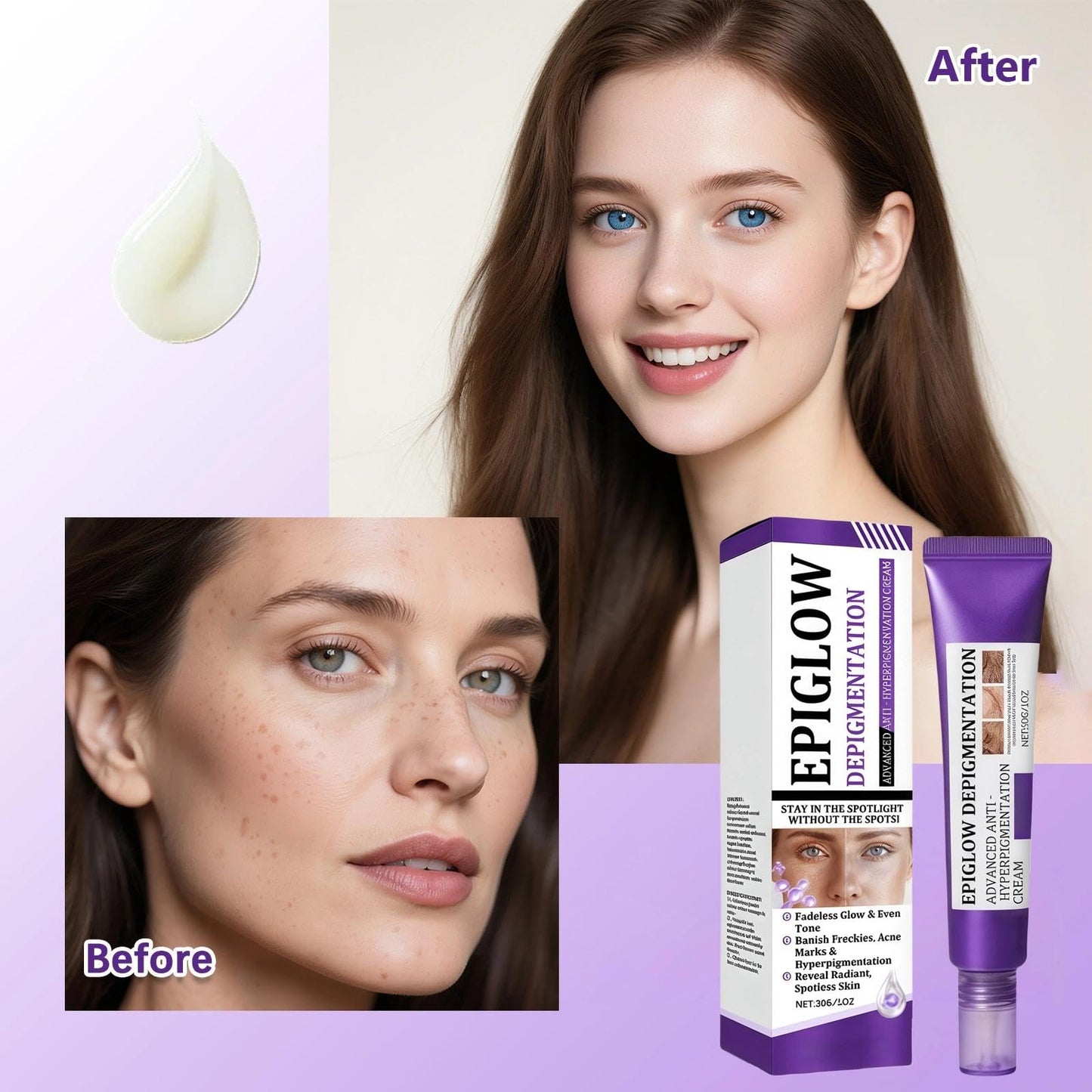 Wormeer Advanced Anti-Hyperpigmentation Cream - Skin Face Cream - Face Moisturisers, Improves Fine Lines, Even Out Skin-Tone, Suitable for All Skin Types - 20g