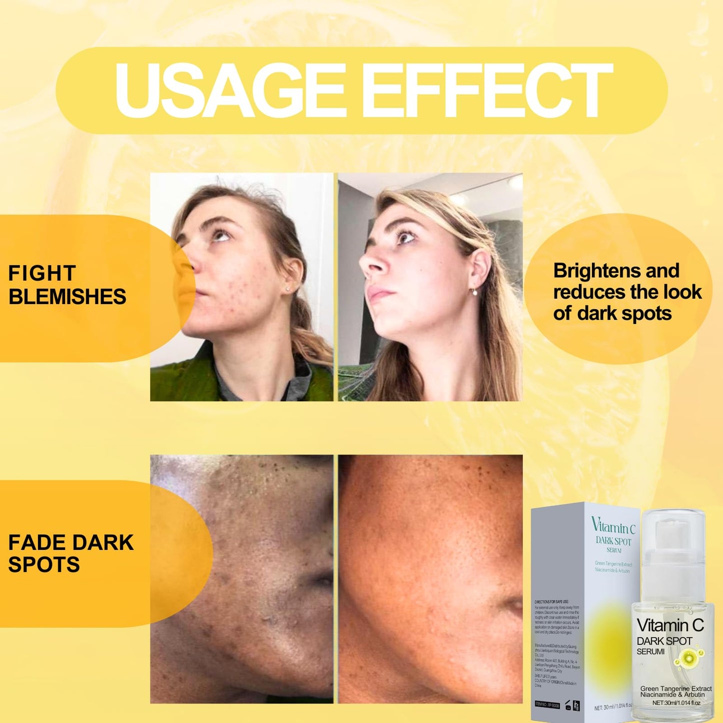 TBeautfave 2PCS Vitamin C Dark Spot Serum – Vitamin C Serum for Face,Brightening Serums for Women,Correcting Glow Serum With Niacinamide,Anti-Dark Spots,Fine Lines&Wrinkle,Korean Skincare,30ml