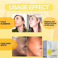 TBeautfave 2PCS Vitamin C Dark Spot Serum – Vitamin C Serum for Face,Brightening Serums for Women,Correcting Glow Serum With Niacinamide,Anti-Dark Spots,Fine Lines&Wrinkle,Korean Skincare,30ml