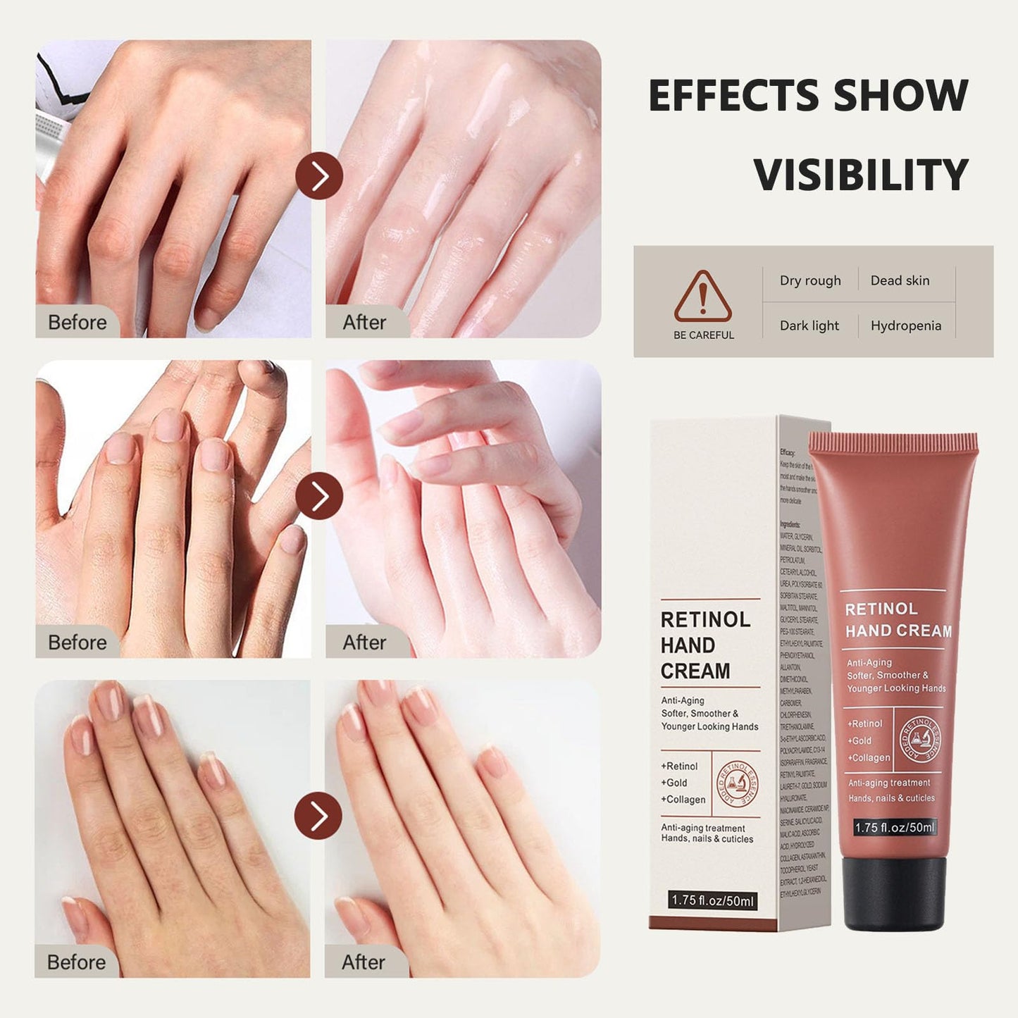 HERBINSOLS Retinol Hand Cream - Anti Aging Hand Cream - Hand Repair Cream Firming & Moisturising - Retinol Moisture Intensive hand cream for Very Dry Hands, Care for Skin, Nails & Cuticles