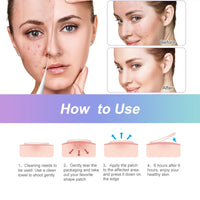 Zngou 144Pcs Pimple Patches Hydrocolloid Spot Patches Absorbing Acne Patch Colourful Acne Dots Spot Stickers Acne Treatment Patch Zit Patch Hydrocolloid Patches for Spot Face Body Blemish Cover Skin Care