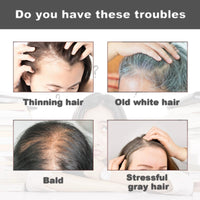 SingHao Hairfi/llup Hair Concealer,Hair Building Fibres for Thinning Hair,Hair fi/llup Hair Concealer,Professional Hair Building Fibres,Hair Loss Conce/aler,Ha/ir Fibers for Men,H/air Con/cealer for Men