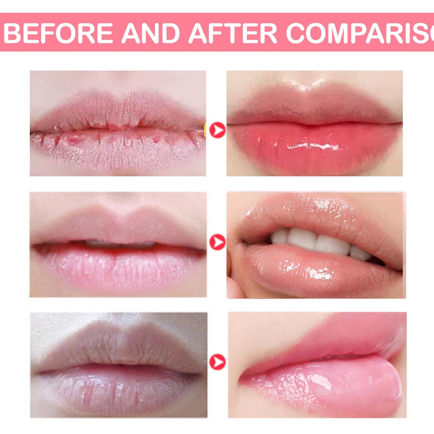 DOOCECIY 6 PCS Honey Lip Bee Balm Set, Moisturizer Fruit Honeybalm for Dry Chapped Peeling Lips