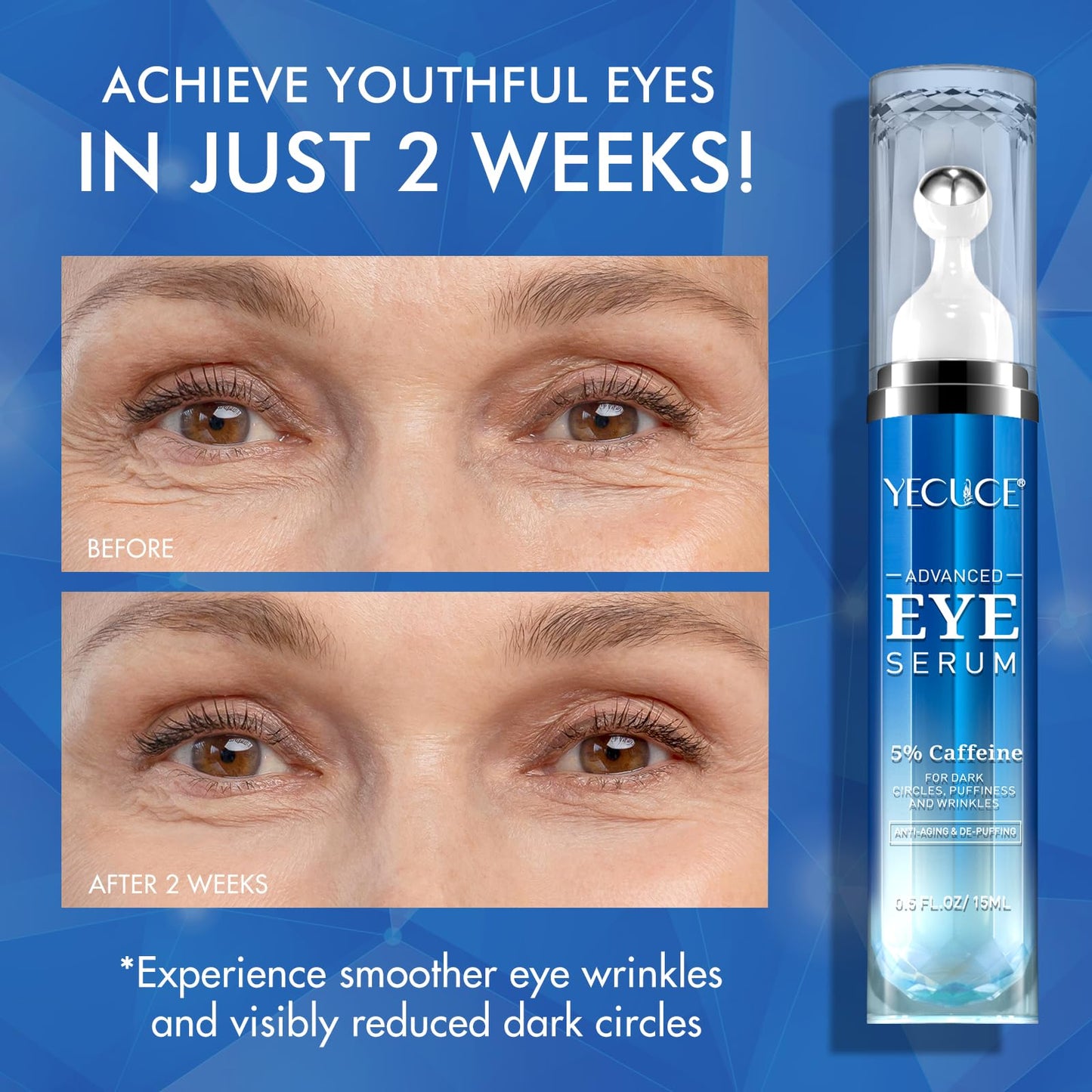 Generic Eye Serum for Dark Circles and Puffiness, Under Eye Serum with 5% Caffeine Anti Aging Smooths Fine Lines and Wrinkle Appearance, Eye Cream with 360° Eye Roller Massage Ball