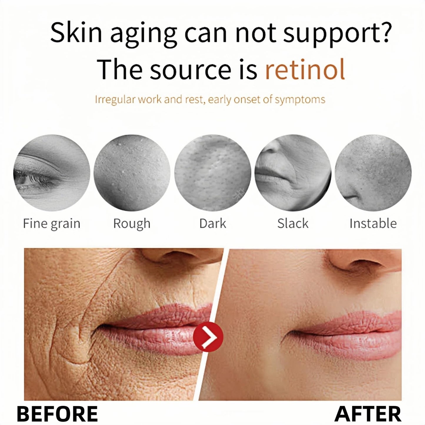Epi-glow Advanced Anti-Hyperpigmentation Cream,Mela-nex Cream for Hyperpigmentation Treatment,Anti Aging Face Cre-am,Retinol Moisturiser,Retinol Serum for Face,Retinoid Cre-am