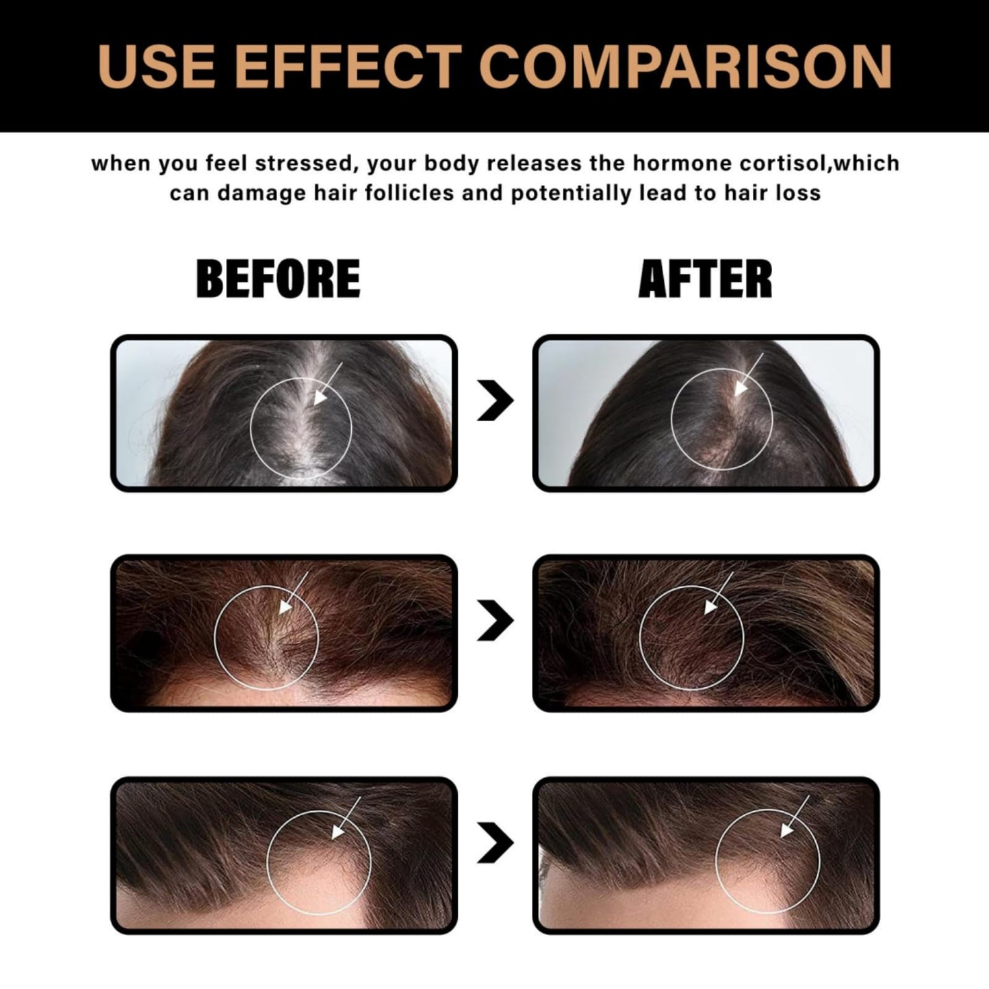 SingHao Spa/rtan Root Activator Shampoo,Unisex Hair Loss Shampoo,Spa/rtan Hair Sh/ampoo,Ma/ne Root Activator Sha/mpoo,H/air Thickening Sha/mpoo,Spar/tan Natural He/rbal Essence Ha/ir Growing Sham/poo