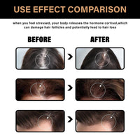 SingHao Spa/rtan Root Activator Shampoo,Unisex Hair Loss Shampoo,Spa/rtan Hair Sh/ampoo,Ma/ne Root Activator Sha/mpoo,H/air Thickening Sha/mpoo,Spar/tan Natural He/rbal Essence Ha/ir Growing Sham/poo
