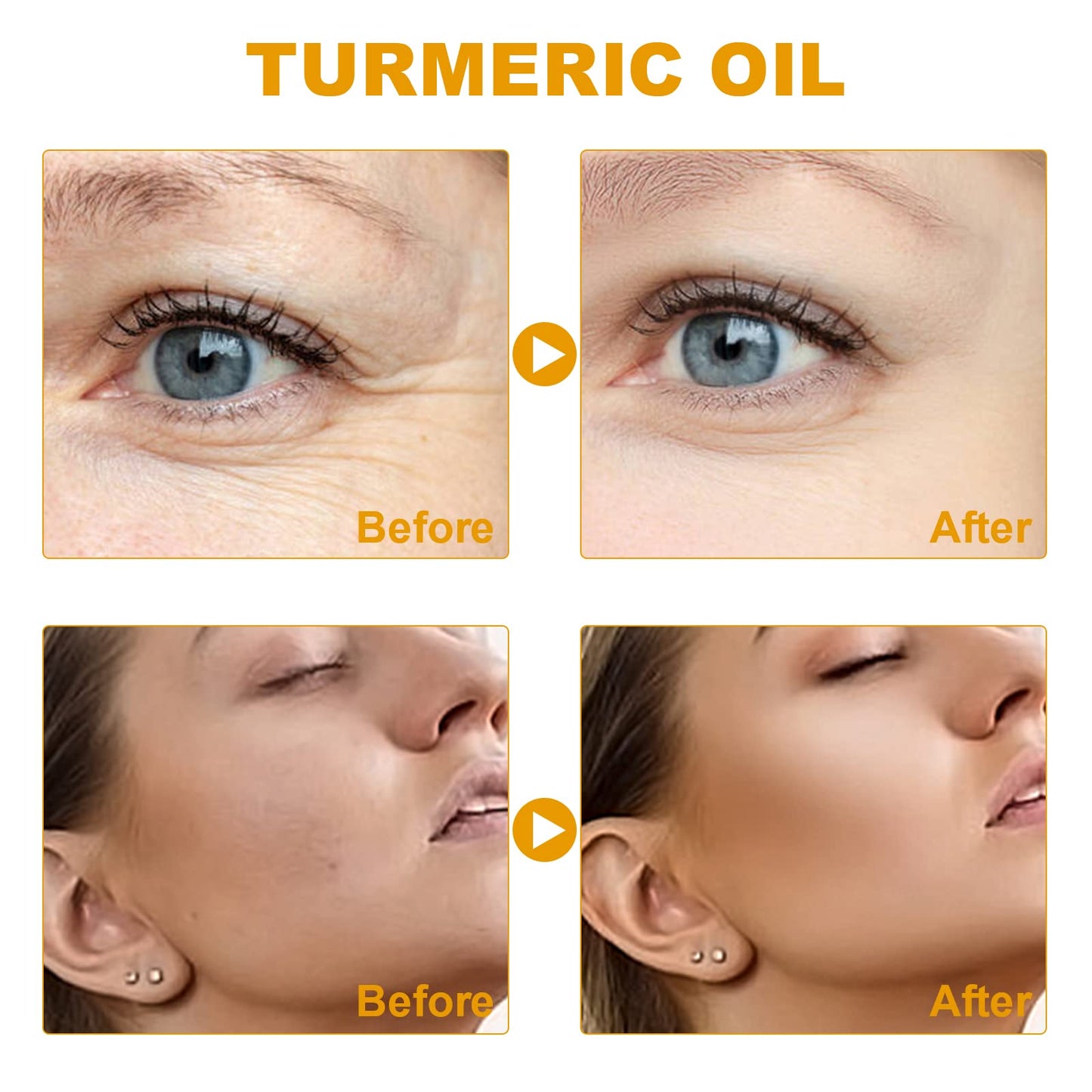 SUNDEER Turmeric Dark Spot Corrector Serum, Turmeric Repair face care Face Serum, Bright Skin Moisturizing Repair Whitening Serum for Face, 2022 New Organic Skin Lightener (1PC)