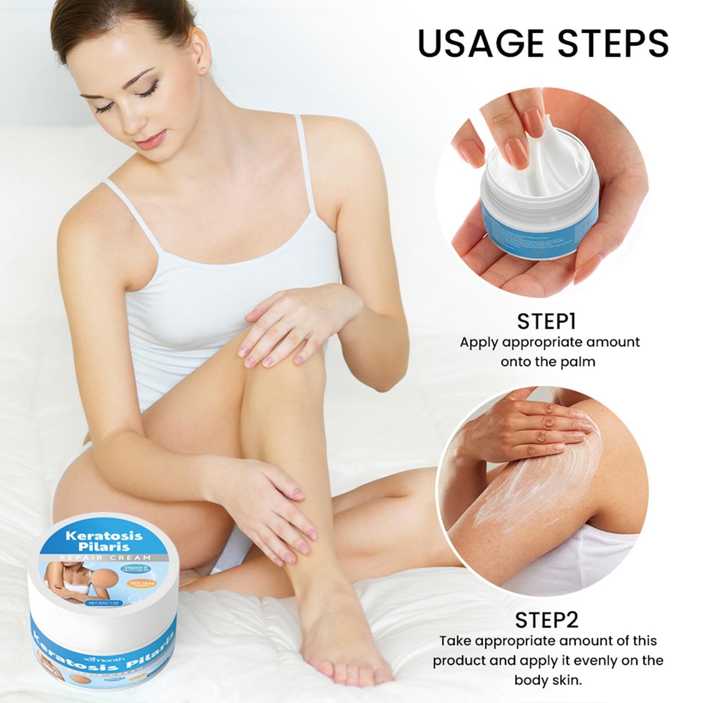 Strawberry Legs Treatment Body Cream,Keratosis Pilaris Cream Treatment with Vitamin E and Urea,Skin Exfoliating Repair Cream for Chicken Skin Treatment,Eliminates Strawberry Spots(30G)
