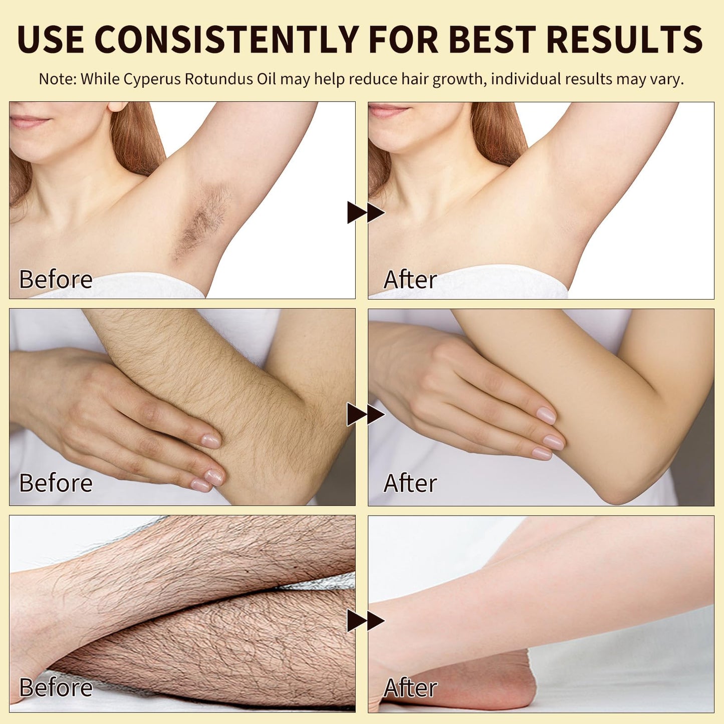 Generic Cyperus Rotundus Oil For Hair Removal, Cyperus Oil 100% Pure Natural, Effective Shrinks Pores, Anti-Hair Growth, Suitable For Hair Removal On The Body And Face 60ml