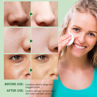 Thalixiry Zero Pores Pads – Exfoliating Face Pads for Deep Cleansing & Smoother Skin – Dual-Textured Gentle Pore Refining Toner Pad for Daily Skincare, Refresh & Delicate Skin 70 Pad