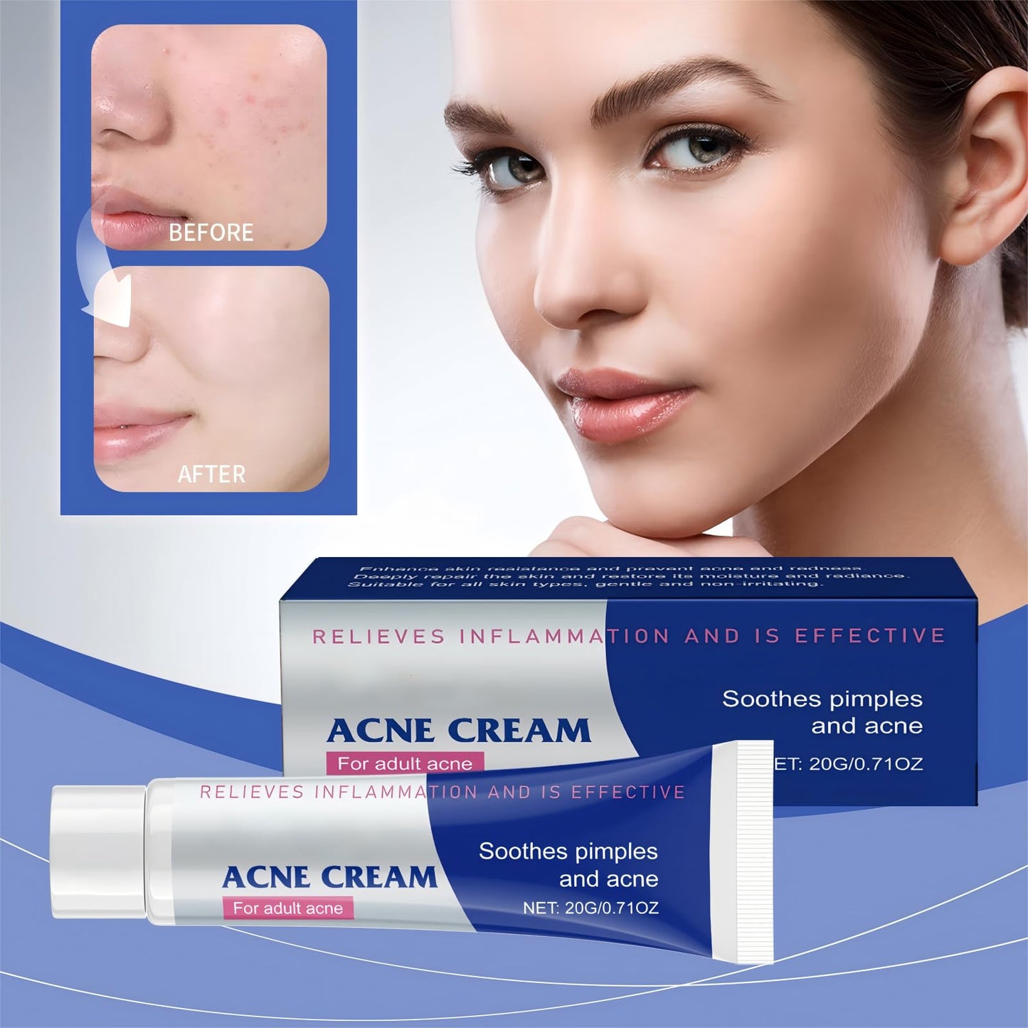 Dabacc Acne Treatment Cream, 40ml Pimple Cream with S-alicylic acid, Fast Acting Spot Treatment for Face, Spot C/ream Reduces Blemishes & Breakouts, Gentle Skin Care for All Skin Types