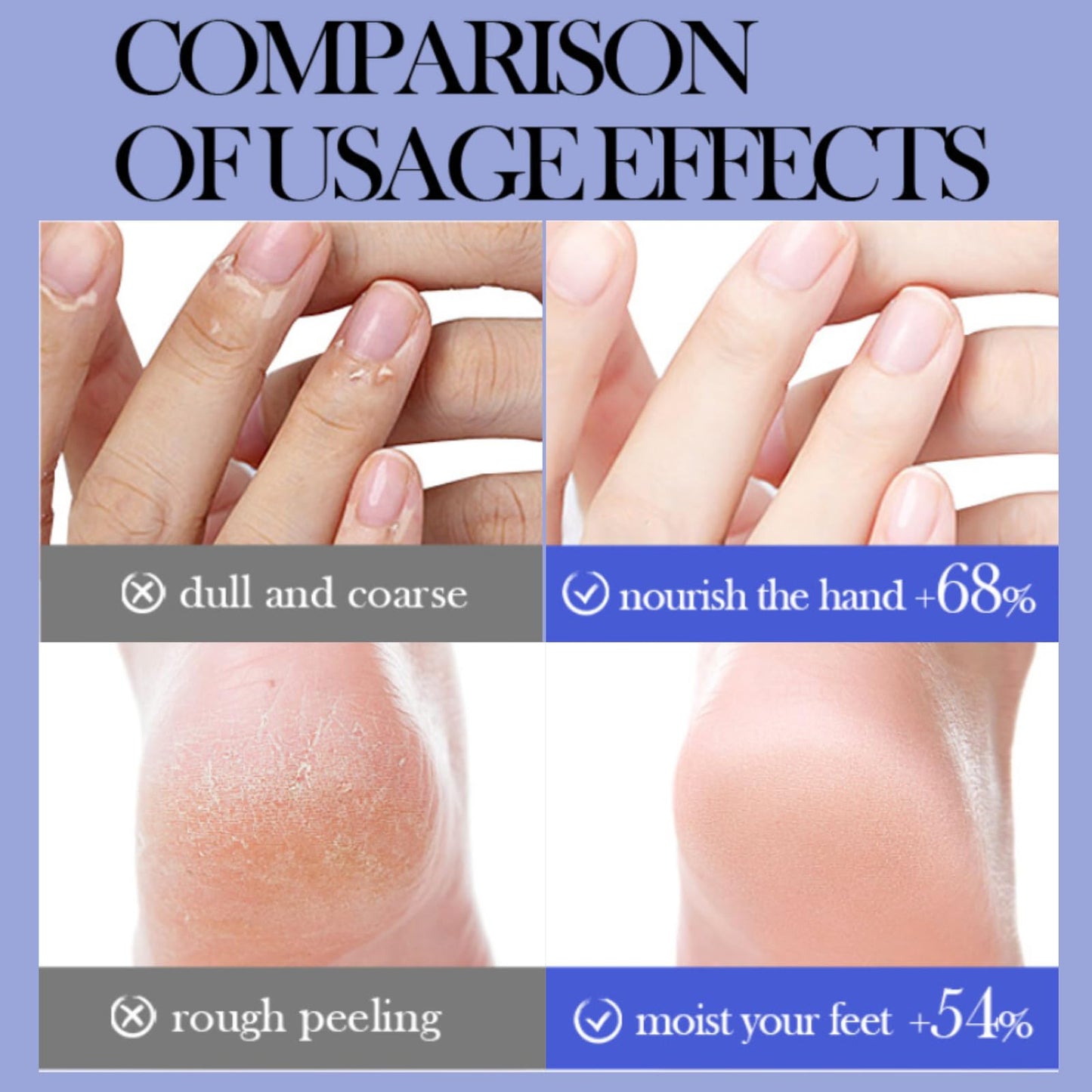 42% Urea Foot Cream Stick– Cracked Heel Repair Cream-Rotating Heel Balm for Very Dry Feet, Calluses & Hard Skin with Salicylic Acid & Shea Butter&Aloe Vera-Twist Design