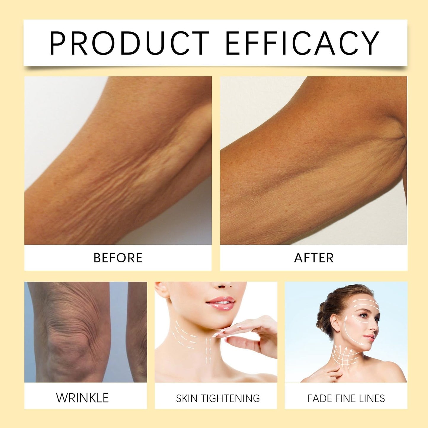 Siyinzu Bee Venom Retinol Skin Cream,Bee Venom Retinol Treatment Cream,Be/e Veno/m Skin Treatment Cre/am,Skin Tightening Cre/am For Face,Retino/l Firming Crea/m,Anti Wrinkle Aging Be/e Veno/m Crea/m