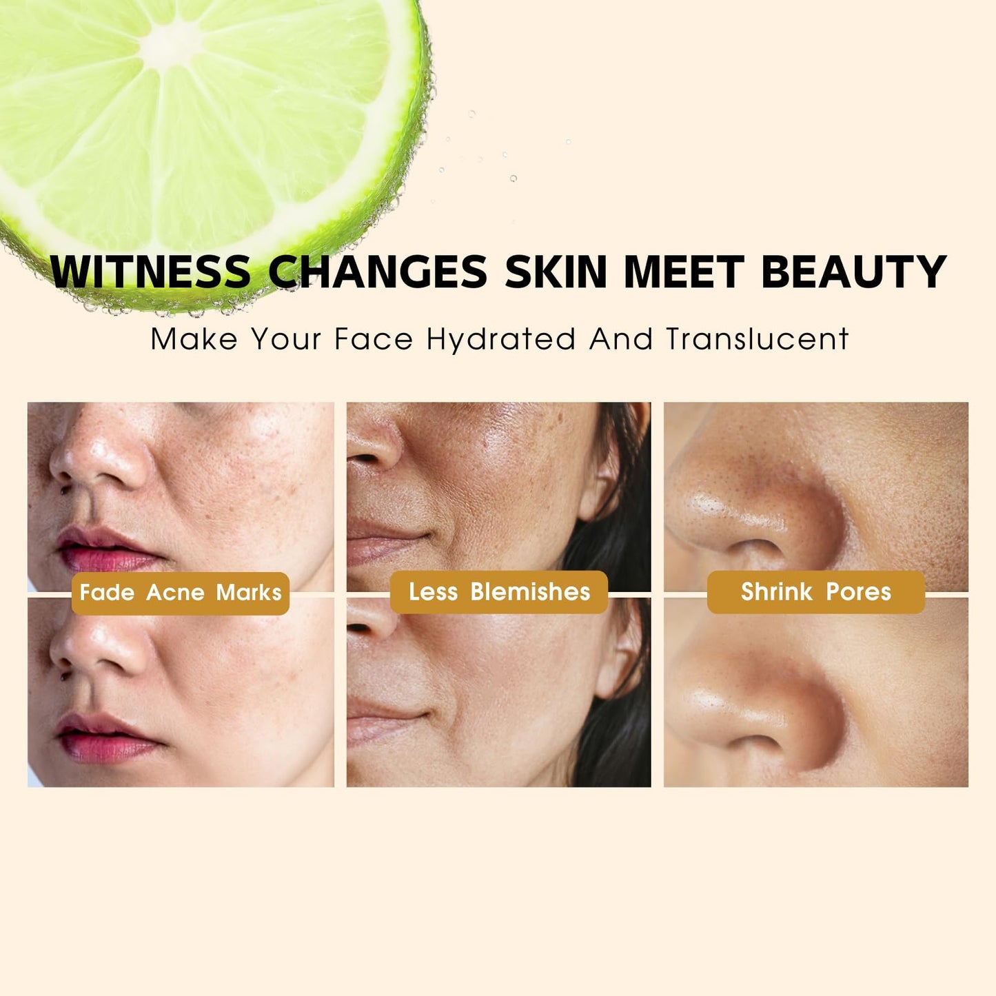 Tongyend Green Lemon Vitamin C Serum for Face, Blemish Serum, Dark Spot Correcting Glow Serum, Brighenting Face Serum for Hyperpigmentation, Fade Acne Marks, Improve Dullness, Shrink Pores, 30ml