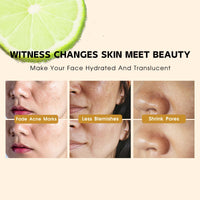 Tongyend Green Lemon Vitamin C Serum for Face, Blemish Serum, Dark Spot Correcting Glow Serum, Brighenting Face Serum for Hyperpigmentation, Fade Acne Marks, Improve Dullness, Shrink Pores, 30ml