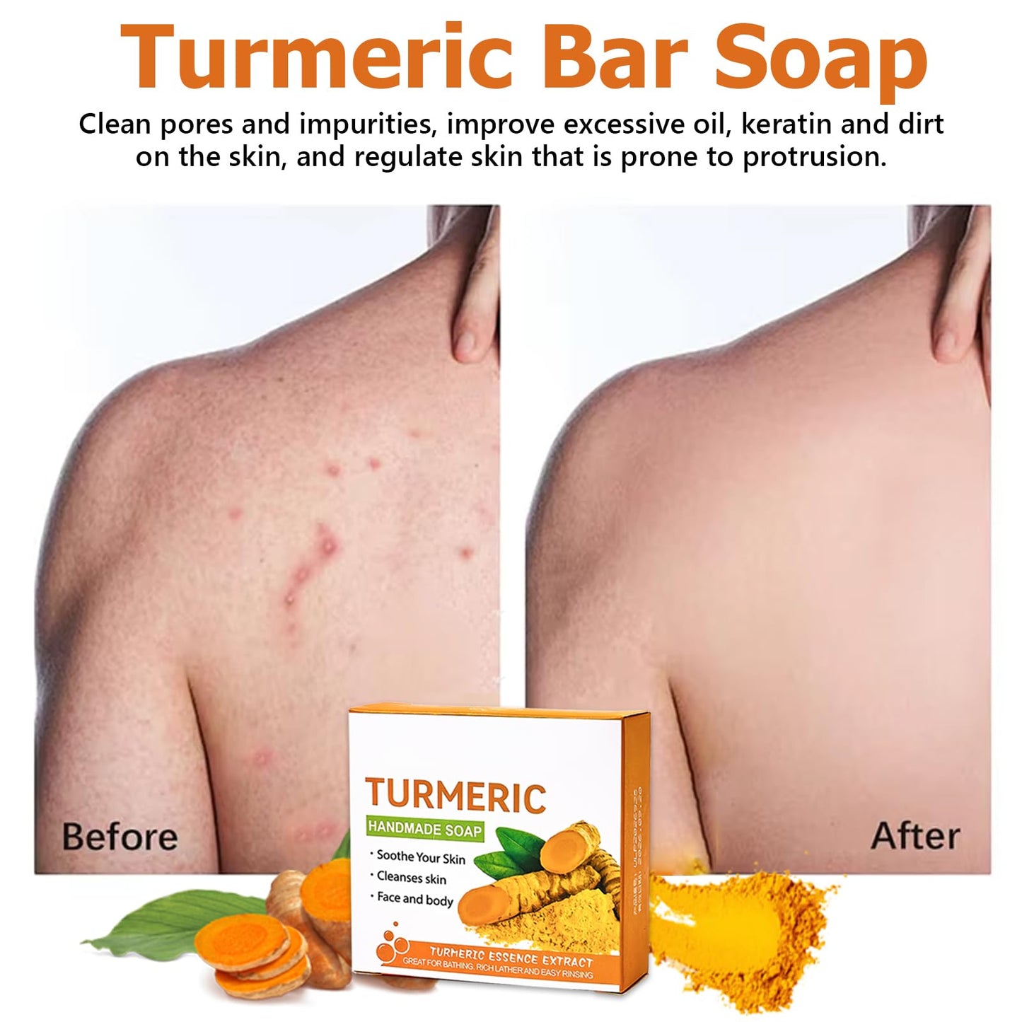 2PCS Wormeer Turmeric Soap Bar, Tumeric Soap for Face & Body,Turmeric Cleansing Bar, Rich in Narious Nutrients, It Is Equipped with a Foam Net to Improve Fine Lines
