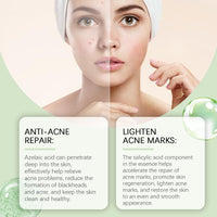 Siyinzu Acid Face Cream,10% Acid Gel For Facial and Skin Care,Ac/id 10% Acne Tratment Ge/l,Anti Acne G/el for Spot Prone Sk/in,Brightening Face S/kin Care Treatment,Dark Spot Serum Cream for Face