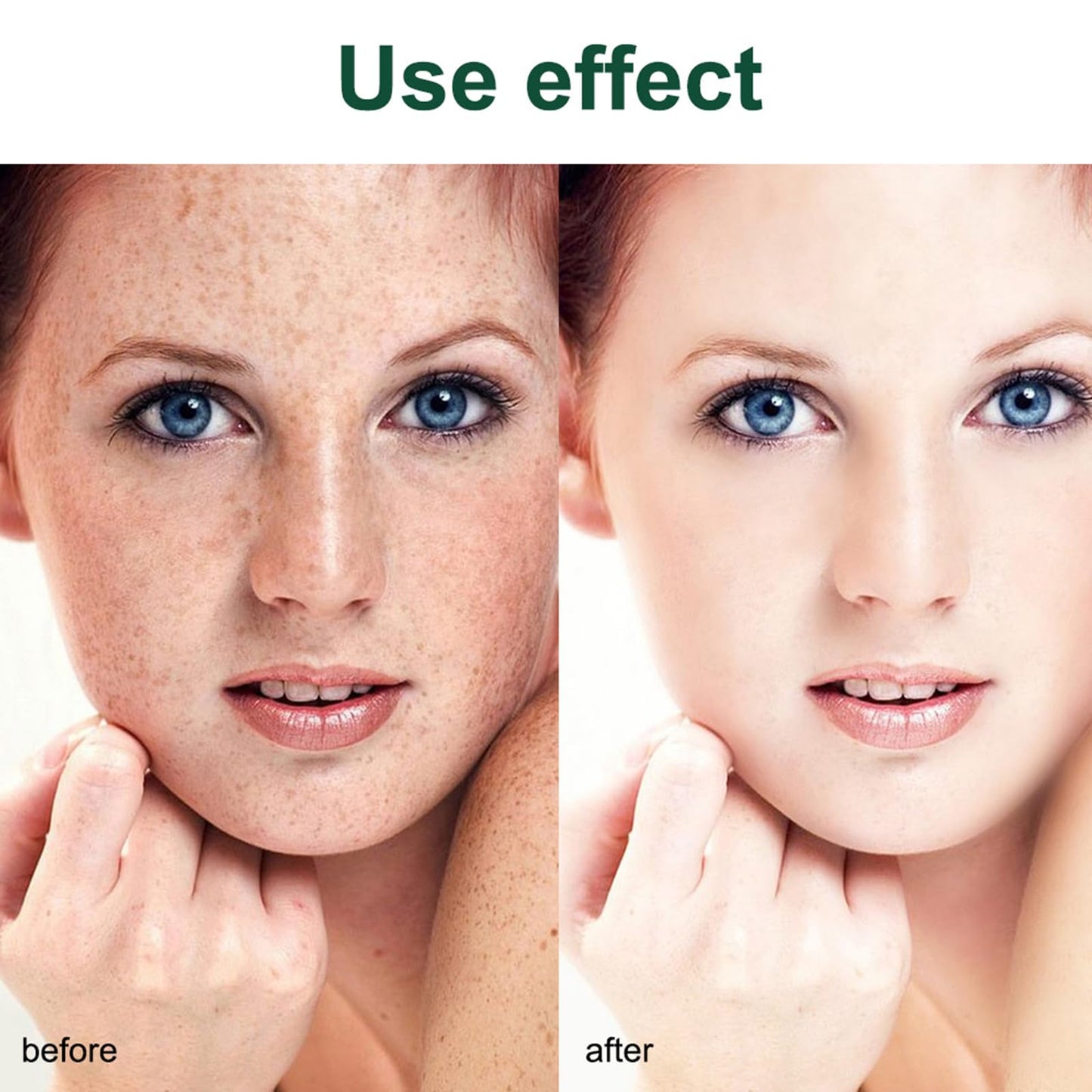 Pack of 2 Whitening Freckle Cream, Anti-Hyperpigmentation Skin Brightening Cream, Anti-Freckle Niacinamide Cream, Face Cream Against Dark Spots, Pigment Spots, Remover Face
