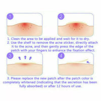 Generic Acne Patches - Pack of 24 Translucent Hydrocolloid Pimple Patch Spot Treatment Stickers for Face and Body - Fast-Acting, Vegan & Cruelty Free Skin Care