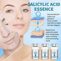 Leogony 5 PCS Serum Micro Infusion Facial System with Roller, Micro Infusion Facial System for Lips for Repair Skin Deep Nourishmen