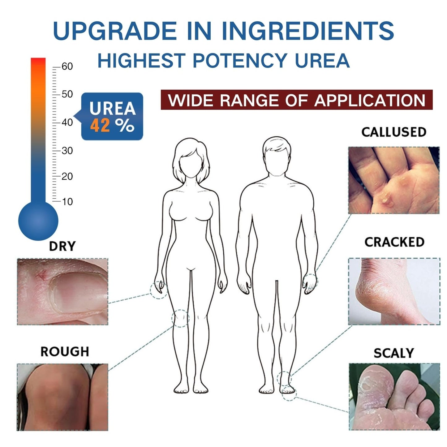 Urea Foot Cream 42% - Foot Cream - Foot Cream for Cracked Heels and Dry Skin - Cracked Heel Repair Cream for Hand and Feet - 42% Urea Cream & 2% Salicylic Acid for Callus Remover & Nourishes Soften