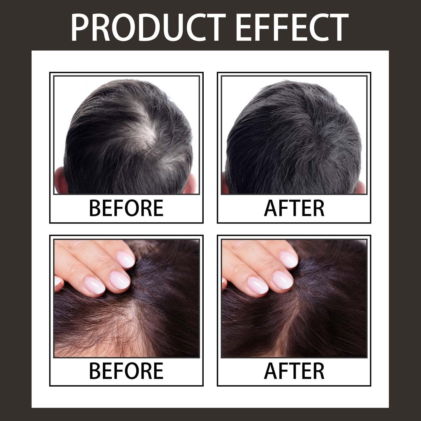 Hair Concealer,Hair Loss Concealer,Root Touch Up Hair Color,Water & Sweat Resistant Hair Loss Con-cealer,Easily Cover Loose Ha-ir,R-oot Cover Up,Ha-ir Root Touch Up,H-air Fibers for Men,Root Co-ver Up